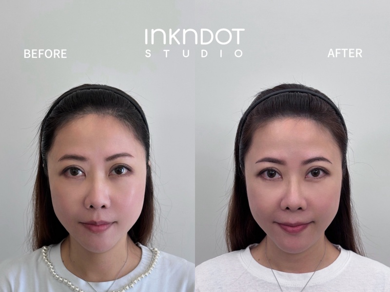 Ink n Dot Studio 髮際線額角美化重塑鵝蛋臉 分線填補讓髮量自然豐盈! @兔貝比的菲比尋嚐 Ink n Dot Studio 髮際線額角美化重塑鵝蛋臉 分線填補讓髮量自然豐盈! @兔貝比的菲比尋嚐