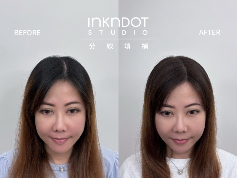 Ink n Dot Studio 髮際線額角美化重塑鵝蛋臉 分線填補讓髮量自然豐盈! @兔貝比的菲比尋嚐 Ink n Dot Studio 髮際線額角美化重塑鵝蛋臉 分線填補讓髮量自然豐盈! @兔貝比的菲比尋嚐