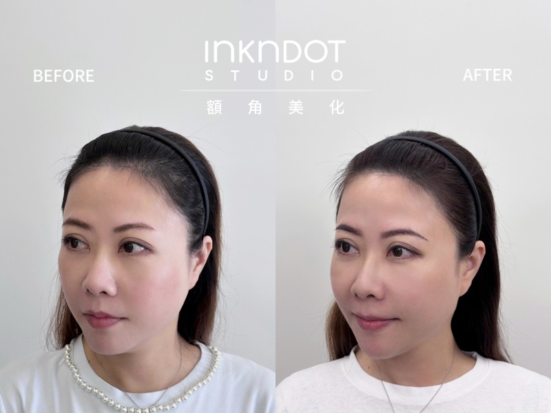 Ink n Dot Studio 髮際線額角美化重塑鵝蛋臉 分線填補讓髮量自然豐盈！ @兔貝比的菲比尋嚐