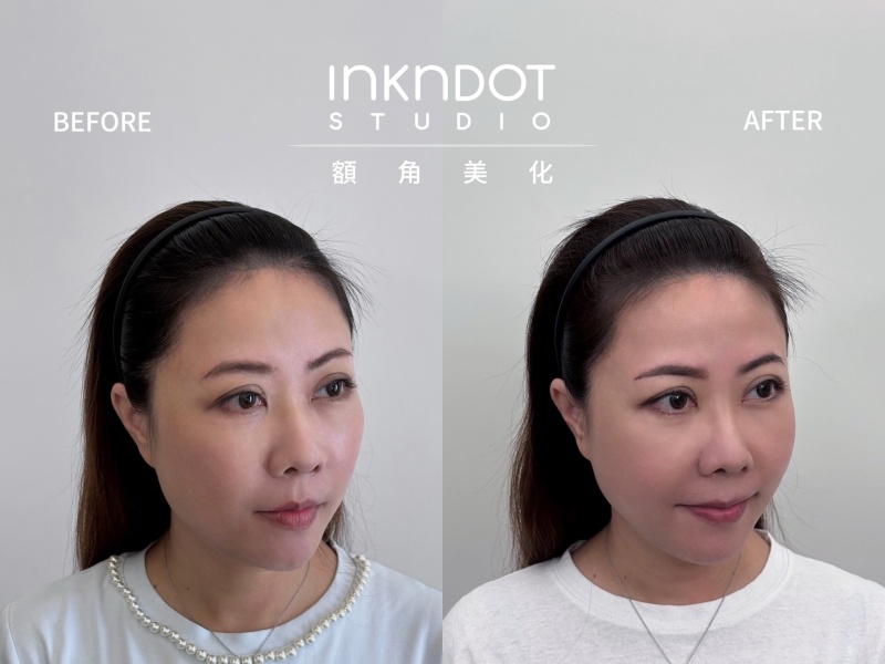 Ink n Dot Studio 髮際線額角美化重塑鵝蛋臉 分線填補讓髮量自然豐盈！ @兔貝比的菲比尋嚐