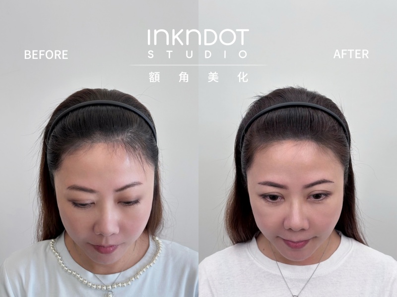 Ink n Dot Studio 髮際線額角美化重塑鵝蛋臉 分線填補讓髮量自然豐盈！ @兔貝比的菲比尋嚐